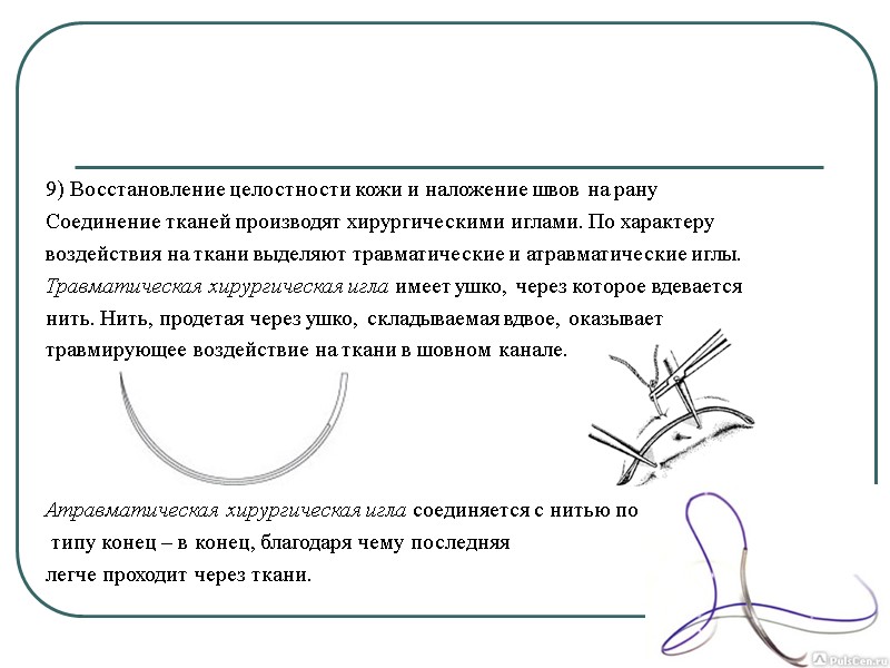 9) Восстановление целостности кожи и наложение швов на рану Соединение тканей производят хирургическими иглами.